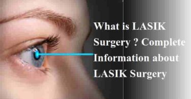 What is LASIK Surgery Complete Information about LASIK Surgery