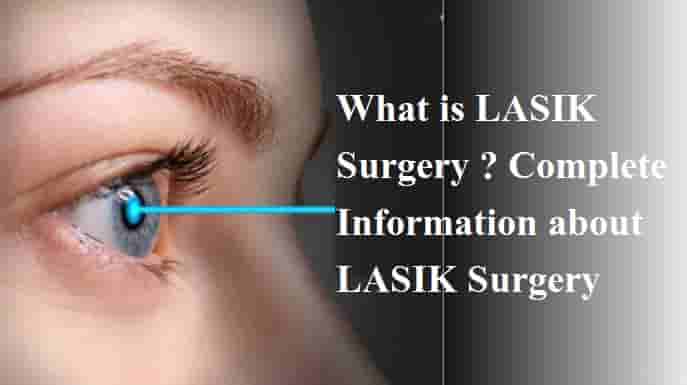 What is LASIK Surgery Complete Information about LASIK Surgery